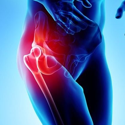 Physio with a specialist interest in the management of young adult hips and lateral hip pain.