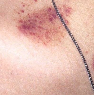 zxc_31z's profile picture. أميمة الراوي زوجين متحررين تريد تجي تدز عمولتي ما اشتغل بس بنضام الحجز يعني تدز كارت وتجي و عندي بنات من كل العراق و يطلعن واذا ما عندك مكان موجود المكان يمي