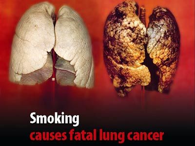 smoking is the leading cause of lung cancer