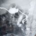minisurgery (@zurgeonphd) Twitter profile photo minisurgery (@zurgeonphd) Twitter profile photo