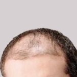 Ilya Sutskever's hairline (@ilyashairline) 's Twitter Profile Photo Ilya Sutskever's hairline (@ilyashairline) 's Twitter Profile Photo
