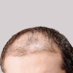 Ilya Sutskever's hairline (@ilyashairline) Twitter profile photo Ilya Sutskever's hairline (@ilyashairline) Twitter profile photo