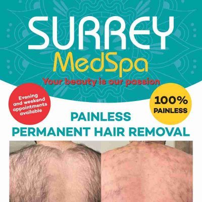 Painless Permanent Hair Removal in Surrey! 
Call 604-725-1307. Evening and weekend appointments available!