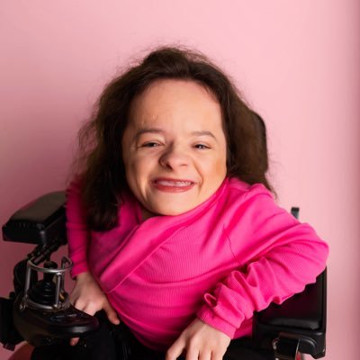 • Internet Personality • Changing the face of beauty • Osteogenesis Imperfecta (Type III) • Michaela Davert OI & Scoliosis Research Fund at @umichmedicine