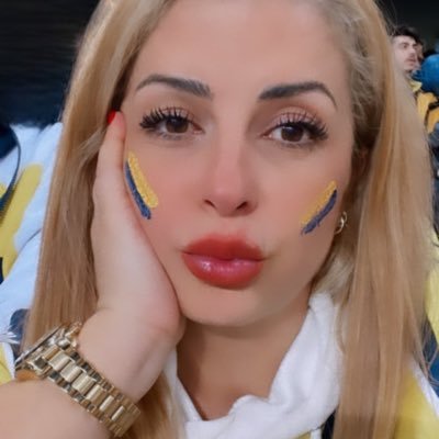 Dar ağacında olsak bile son sözümüz Fenerbahçe 💙💛