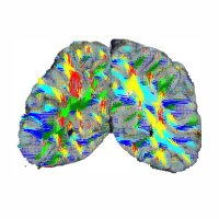 Neuropathology UniBern (@npth_unibern) 's Twitter Profile Photo Neuropathology UniBern (@npth_unibern) 's Twitter Profile Photo