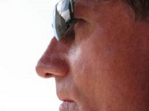 wilco602003's profile picture. ...retired as Head of European AXE Network Support for a US telco 12/2007 and part-time consultancy 03/2011...living with Parkinson's for 8 years now, joy!