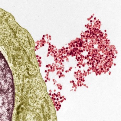 Lymphocyte activation & susceptibility to Epstein-Barr virus