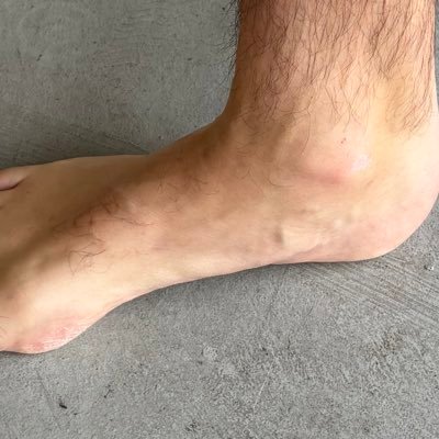 #feet #feetpics #foot #feetfinder https://t.co/ehbYLkuhTG