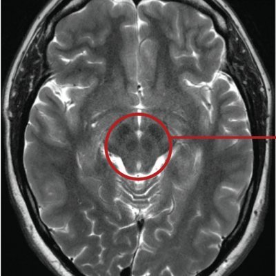 Neurosciences, neurosurgery and research.