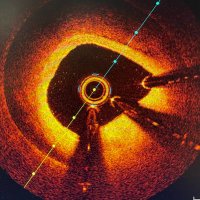 Hemodinámica Son Espases (@hemosonespases) 's Twitter Profile Photo Hemodinámica Son Espases (@hemosonespases) 's Twitter Profile Photo