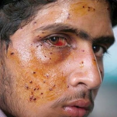 I am a Kashmiri who is being killed, tortured, blinded & exploited by the politicians of J&K 
I am a Kashmiri and i dream to live a peaceful life.