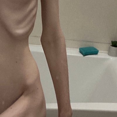 TW 18+ my (ed) diary 🍓bulimic ///biadolenie