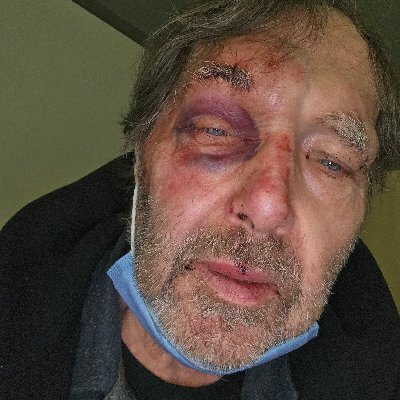 Will21st's profile picture. Twitter is like online graffiti. For every Banksy, there are a thousand poor deluded people spewing out poorly researched hatred.