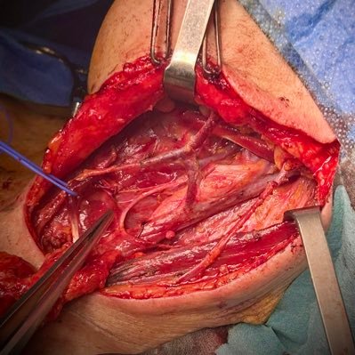 Cirurgia Endocrina i d’Obesitat. Hospital Germans Trias i Pujol Badalona