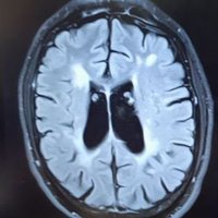 Sclerosis (@know_the_enemy7) 's Twitter Profile
