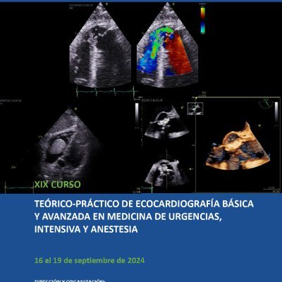 Curs Ecocardiografia Avançada en UCI i Anestèsia
Advance Course in Echocardiography for ICU and Anesthesia
Curso Avanzado en Ecoardiografia para UCI y Anestesia