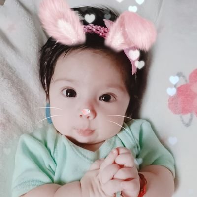 todoporestelita's profile picture. soy Estelita! naci con paladar hendido, hipoacusia severa bilateral, pie equino varo epilepsia, displasia de cadera, microtia y Síndrome de Pierre Rodin!