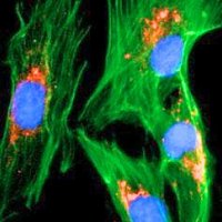 Chordoma Foundation Labs (@cflabsresearch) 's Twitter Profile Photo Chordoma Foundation Labs (@cflabsresearch) 's Twitter Profile Photo