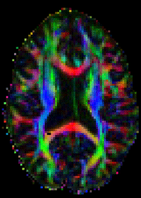 EdinUniFUSION Profile