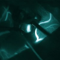 BNVG (@britneurovasc) 's Twitter Profile Photo BNVG (@britneurovasc) 's Twitter Profile Photo