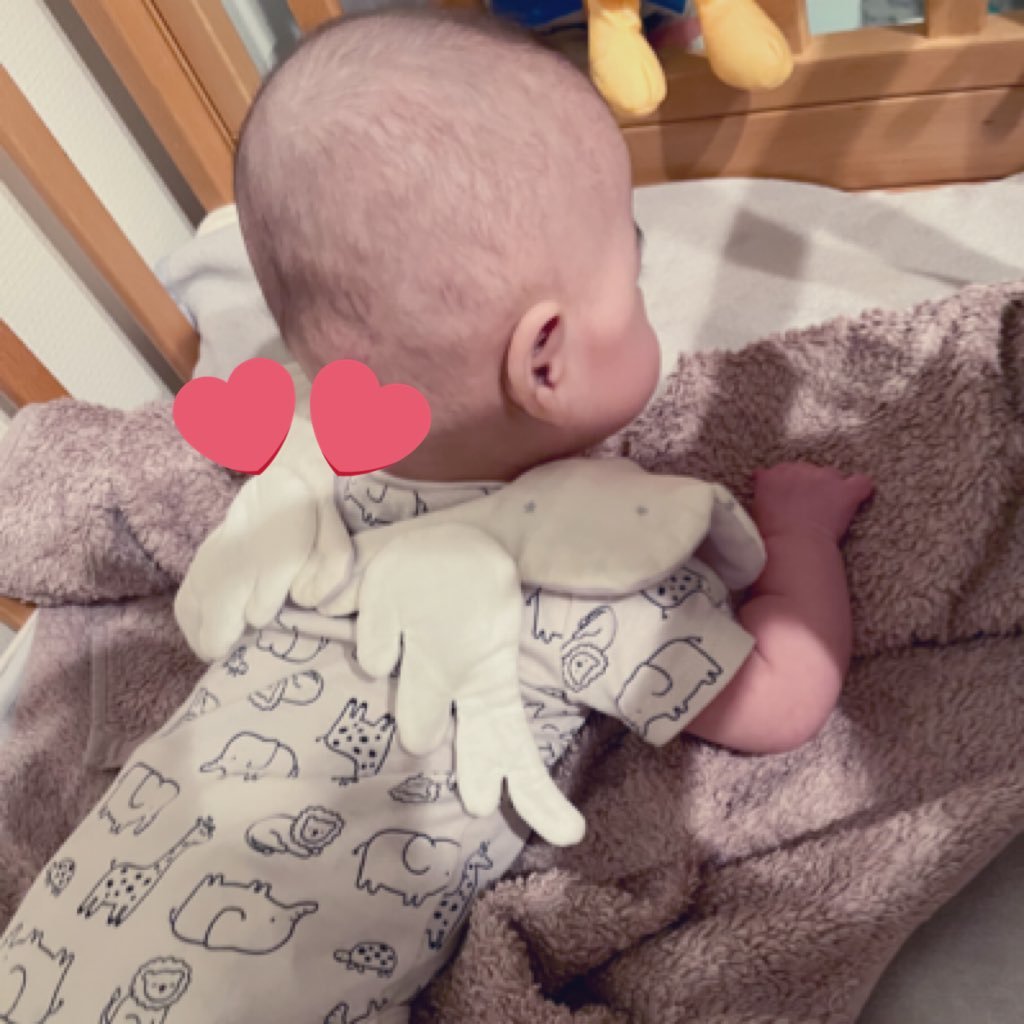 妊娠高血圧腎症/HELLP syndromeのため緊急帝王切開。25W1dで531gの超低出生体重児出産👧。NICUに約半年入院。🥚第二子妊娠中。#水頭症#脳室内出血後水頭症#VPシャント#HELLP症候群