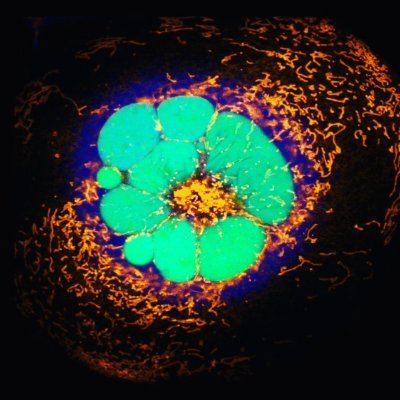 Researching how neurons degenerate after chemotherapy and other neurodegenerative diseases at Temple University.
Visit https://t.co/yBywSiWgB1 for more info!