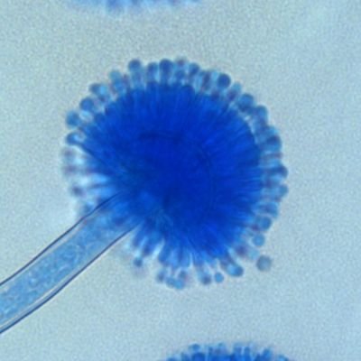 ASCPi Specialist in Microbiology/ASCP IMLS
Researcher