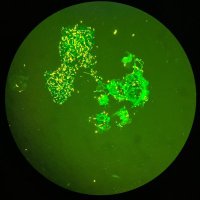 Bart’s Health TB (@bartshealthtb) 's Twitter Profile Photo Bart’s Health TB (@bartshealthtb) 's Twitter Profile Photo