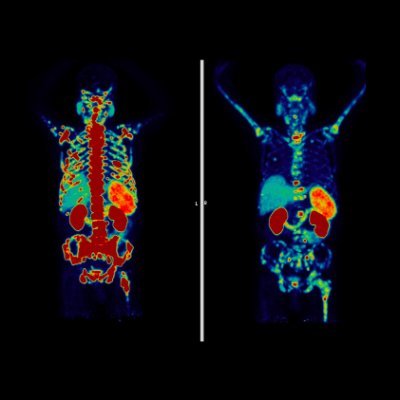 Conference focused on theranostics. 2026 conference will be held in Los Angeles on March 26-27. Co-sponsored by UCLA/UCSF/PCF.