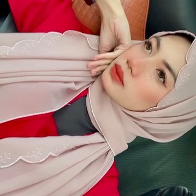 still cute with acne cause there is beauty in our scars