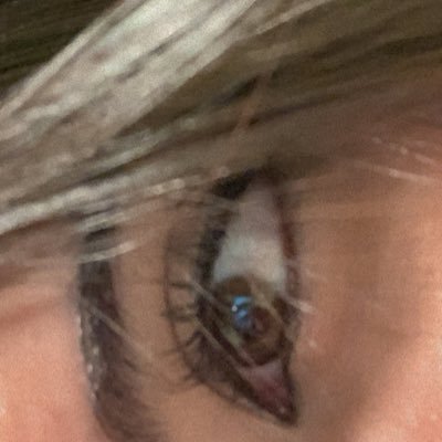 __silvaahui's profile picture. sepso