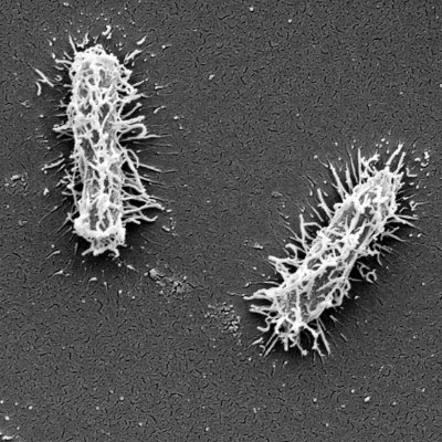 We are led by @yunnhwen and are dedicated to Klebsiella pnuemoniae research. Tweets are by lab members and do not represent the opinions of our institute