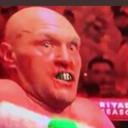 boxingnut69's profile picture. blowing about in the wind