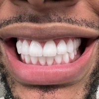 CareFreeBubss 🃏 (@carefreebubss) 's Twitter Profile Photo CareFreeBubss 🃏 (@carefreebubss) 's Twitter Profile Photo