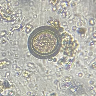 mls_ike's profile picture. On God||Medical Laboratory Scientist||Mmerante3||KnustSMD||DCM. https://t.co/ZlmrsZRD4l