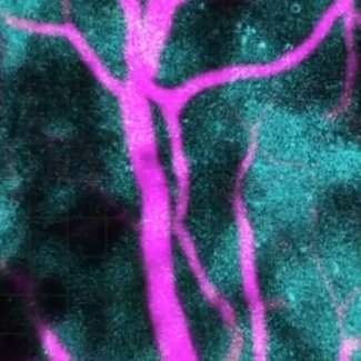 The Aging Brain Initiative @ MIT is a research effort to create new therapies & technologies for neurodegenerative diseases.