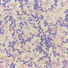 megothelioma's profile picture. MD/MPH. Pathology fellow. Always learning.
Active on BlueSky: https://t.co/NuKzBEyyDx