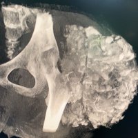 جراحة العظام بالمدينة الطبية الجامعية (@orthopedics_umc) 's Twitter Profile