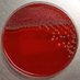 Infectious_Diseases (@microbe_phd) Twitter profile photo Infectious_Diseases (@microbe_phd) Twitter profile photo