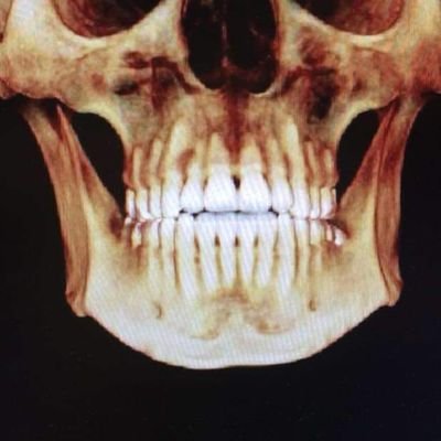 Mestrando em Estat (IMECC-Unicamp), BSc em Econ (FEA-USP). Gosto de causalidade. Glória a Bayes! Eu não passo de um malandro/De um moleque do Brasil