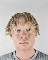 Sou albino , sou ateu , graças a Deus