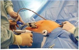 We are a general surgery/colorectal group specializing in minimally invasive surgery