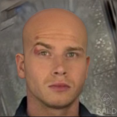 Im not getting bald. Im just getting more head.