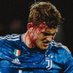 De Ligt (@utdeligt4) Twitter profile photo De Ligt (@utdeligt4) Twitter profile photo