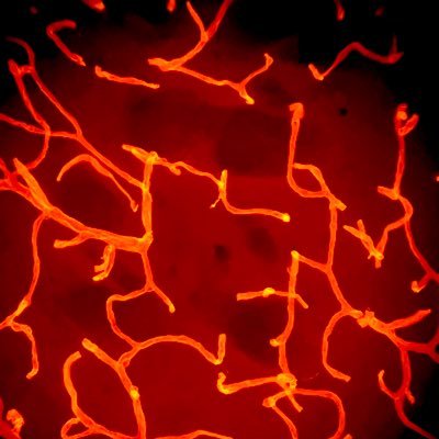 #neuroscience #bloodbrainbarrier #Immunofluorescence @ https://t.co/U2YcBhltRP