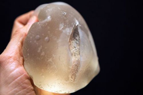 We're an all female team of solicitors who can help you claim for FREE removal of your PIP breast implants!