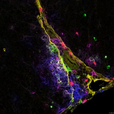ZandeeLab @TheNeuro_MNI @mcgillu @LudmerCentre working on multiple sclerosis pathology 🧠 single cell approaches, applied machine learning @StephanieZandee