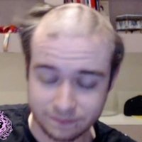 CH Broca (@broca8359373052) 's Twitter Profile