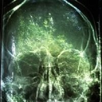 Gratwhel 「🇪🇺🇩🇪🏳️🌈😷💉」 (@gratwhel) 's Twitter Profile